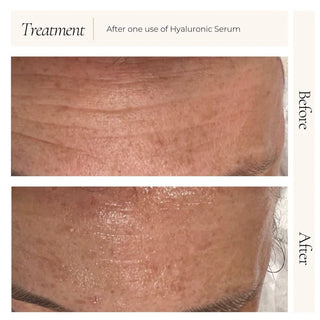 Hyaluronic Serum