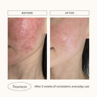 ISO Cell Recovery Mist